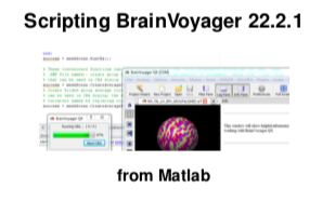 ScriptingBV2221FromMatlabFront